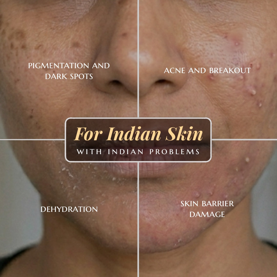 Facial skin issues with text labels on a close-up of skin texture.