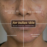 Facial skin issues with text labels on a close-up of skin texture.