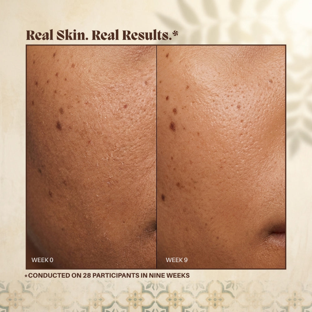 Close-up of a cheek at week 0 and week 9 of the in-house study of 28 participants, card titled Real Skin Real Results