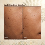 Close-up of a cheek at week 0 and week 9 of the in-house study of 28 participants, card titled Real Skin Real Results